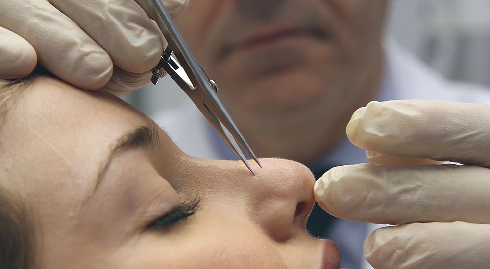 rinoplastia